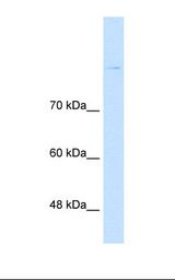 Lane A: Marker. Lane B: Jurkat cell lysate. Antibody concentration: 1.0 ug/ml. Gel concentration: 8%.