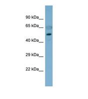 Western blot of Human Fetal Stomach. CDH8 antibody dilution 1.0 ug/ml.