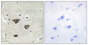 IHC of paraffin-embedded human brain tissue, using CDH8 Antibody. The picture on the right is treated with the synthesized peptide.