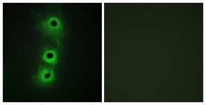 Immunofluorescence of COS7 cells, using CDH8 Antibody. The picture on the right is treated with the synthesized peptide.