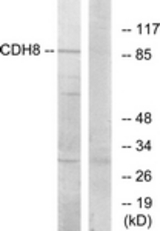 Western blot of extracts from RAW264.7 cells, using CDH8 Antibody. The lane on the right is treated with the synthesized peptide.