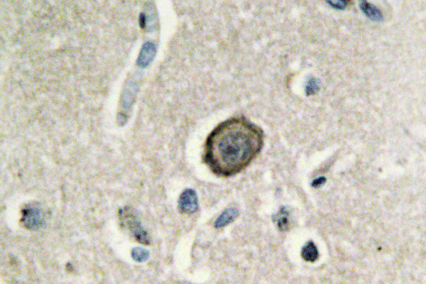 IHC of Cadherin-8 (A519) pAb in paraffin-embedded human brain tissue.