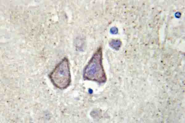 Immunohistochemistry (IHC) analysis of Cadherin-9 (P222) pAb in paraffin-embedded human brain tissue.