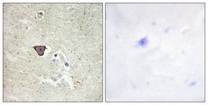 IHC of paraffin-embedded human brain tissue, using CDH9 Antibody. The picture on the right is treated with the synthesized peptide.