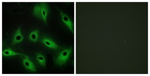 Immunofluorescence of HeLa cells, using CDH9 Antibody. The picture on the right is treated with the synthesized peptide.