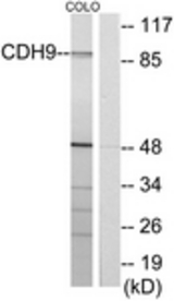 Western blot of extracts from COLO cells, using CDH9 Antibody. The lane on the right is treated with the synthesized peptide.