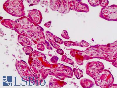 Human Placenta: Formalin-Fixed, Paraffin-Embedded (FFPE)