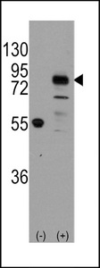 Western blot of CDH9 (arrow) using rabbit polyclonal CDH9 Antibody. 293 cell lysates (2 ug/lane) either nontransfected (Lane 1) or transiently transfected with the CDH9 gene (Lane 2) (Origene Technologies).