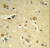 Formalin-fixed and paraffin-embedded human brain tissue reacted with CDIPT Antibody , which was peroxidase-conjugated to the secondary antibody, followed by DAB staining. This data demonstrates the use of this antibody for immunohistochemistry; clinical relevance has not been evaluated.