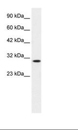 Jurkat Cell Lysate