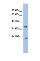 CDK1 antibody LS-C112272 Western blot of SYSY Cell lysate. Antibody concentration 1 ug/ml.