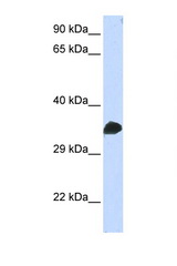 CDK1 antibody LS-C112274 Western blot of Fetal Muscle lysate. Antibody concentration 1 ug/ml.