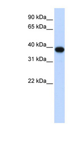 CDK1 antibody LS-C112190 Western blot of 293T cell lysate.