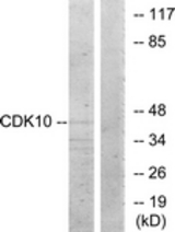 Western blot of extracts from 293 cells, using CDK10 Antibody. The lane on the right is treated with the synthesized peptide.