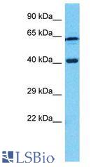 CDK10 antibody Western Blot of MCF7. Antibody dilution: 1 ug/ml.