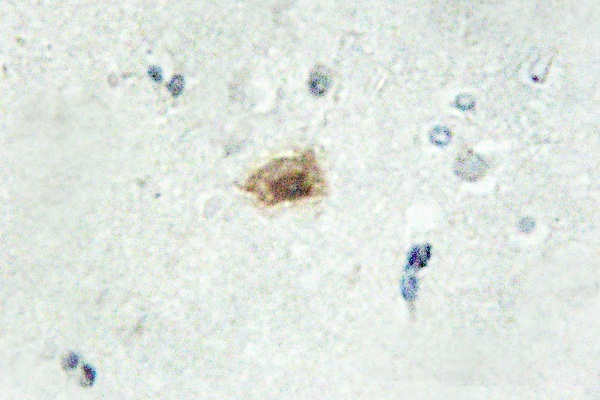 IHC of Cdk10 (E63) pAb in paraffin-embedded human brain tissue.