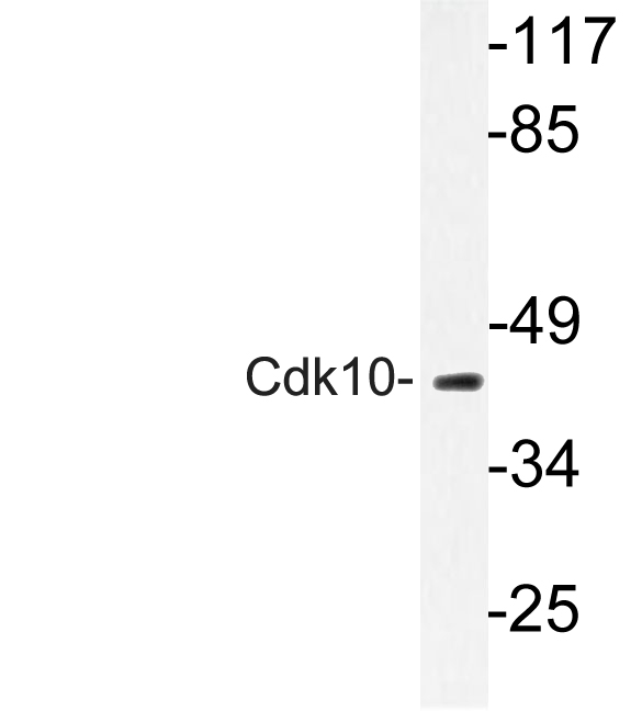 Western blot of Cdk10 (E63) pAb in extracts from 293 cells.