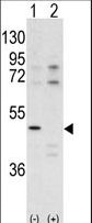 Western blot of CDK10 antibody pre-incubated with (Lane1) and without (Lane 2) blocking peptide in A375 cell line lysate. CDK10 (arrow) was detected using the purified antibody.