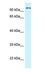 CDK11A / CDC2L2 antibody Western Blot of Fetal Brain.
