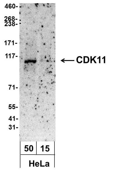 Detection of Human CDK11 by Western Blot. Samples: Whole cell lysate from HeLa (50 and 15 ug). Antibody: Affinity purified, biotin-conjugated, rabbit anti-CDK11 antibody used at 1.0 ug/ml. Detection: Streptavidin-HRP and chemiluminescence with an exposure time of 3 minutes.