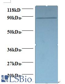 Western blot of Cyclin-dependent kinase 11A antibody at 2 ug/ml + 293T whole cell lysate. Secondary: Goat polyclonal to Rabbit IgG at 1:15000 dilution. Predicted band size: 87 kDa. Observed band size: 87 kDa.
