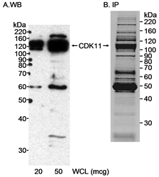 Detection of human CDK11 in whole cell lysates (WCL) of HeLa cells by Western blotting with Rabbit anti-Human CDK11 (LS-C56915) and by immunoprecipitation with LS-C56915. the immunoprecipitate was resolved on a 4-20% gel , subsequently Coomassie stained and the CDK11 band was confirmed by mass spectrometry.