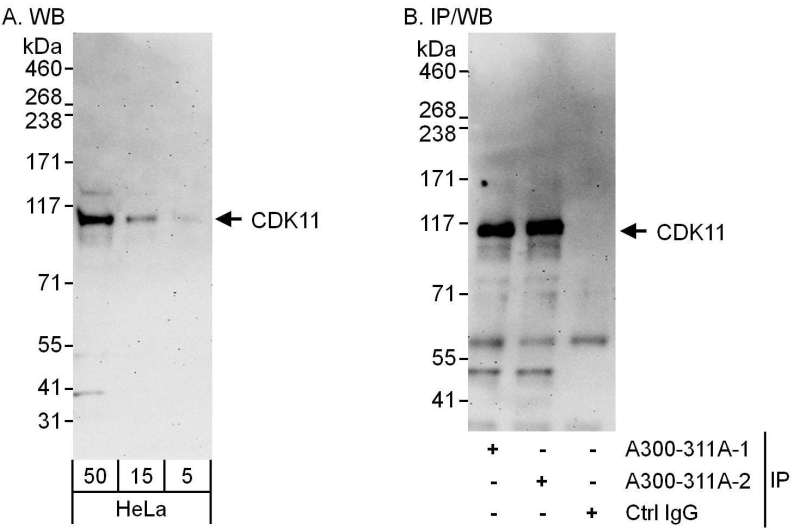 Detection of Human CDK11 by Western Blot and Immunoprecipitation. Samples: Whole cell lysate (5, 15 and 50 ug for WB; 1 mg for IP, 20% of IP loaded) from HeLa cells. Antibodies: Affinity purified rabbit anti-CDK11 antibody used for WB at 0.1 ug/ml (A) and 1 ug/ml (B) and used for IP at 3 ug/mg lysate. CDK11 was also immunoprecipitated by a previous lot of. Detection: Chemiluminescence with exposure times of 3 minutes(A and B).