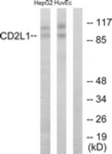 Western blot of extracts from HUVEC/HepG2 cells, using CDC2L1 Antibody. The lane on the right is treated with the synthesized peptide.