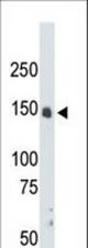 The anti-CRK7 antibody is used in Western blot to detect CRK7 in mouse liver tissue lysate.