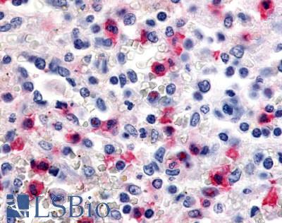 Anti-CDK12 / CRKRS antibody LS-A7320 IHC of human spleen. Immunohistochemistry of formalin-fixed, paraffin-embedded tissue after heat-induced antigen retrieval.