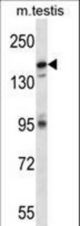 Mouse Cdk13 Antibody western blot of mouse testis tissue lysates (35 ug/lane). The Cdk13 antibody detected the Cdk13 protein (arrow).