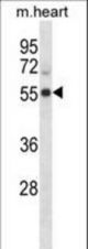 Mouse Cdk15 Antibody western blot of mouse heart tissue lysates (35 ug/lane). The Cdk15 antibody detected the Cdk15 protein (arrow).
