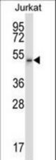Mouse Cdk15 Antibody western blot of Jurkat cell line lysates (35 ug/lane). The Cdk15 antibody detected the Cdk15 protein (arrow).