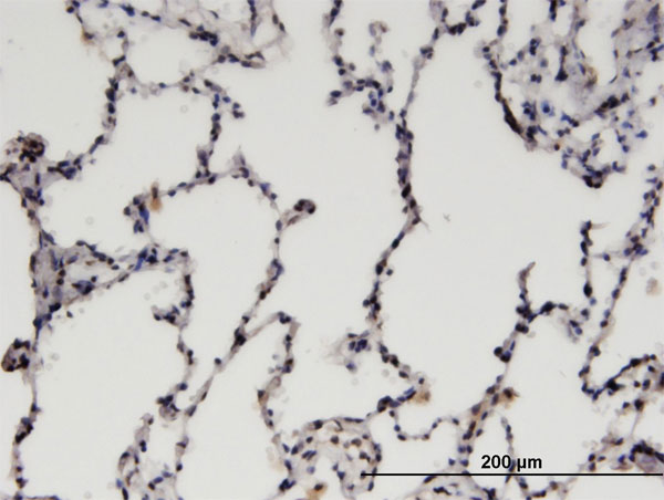 Immunoperoxidase of monoclonal antibody to CDC2L6 on formalin-fixed paraffin-embedded human lung. [antibody concentration 3 ug/ml]