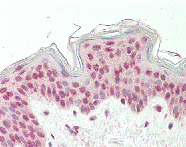 Human Skin: Formalin-Fixed, Paraffin-Embedded (FFPE)