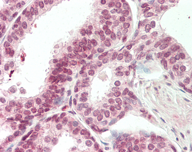 Human Prostate: Formalin-Fixed, Paraffin-Embedded (FFPE)