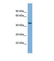 Western blot of Human Jurkat. CDK19 antibody dilution 1.0 ug/ml.