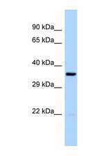 CDK20 / CCRK antibody LS-C145360 Western blot of 8226 Cell lysate. Antibody concentration 1 ug/ml.