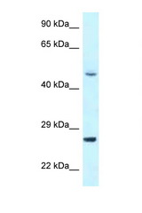 CDK20 / CCRK antibody LS-C145730 Western blot of Jurkat Cell lysate. Antibody concentration 1 ug/ml.