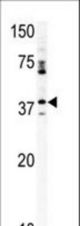 Western blot of anti-CCRK antibody in mouse kidney tissue lysate (35 ug/lane). CCRK(arrow) was detected using the purified antibody.