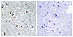IHC of paraffin-embedded human brain tissue, using CDKA2 Antibody. The picture on the right is treated with the synthesized peptide.