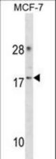 CDK2AP2 Antibody western blot of MCF-7 cell line lysates (35 ug/lane). The CDK2AP2 antibody detected the CDK2AP2 protein (arrow).