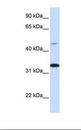 Hela cell lysate. Antibody concentration: 1.0 ug/ml. Gel concentration: 12%.
