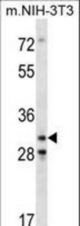 Mouse Cdk4 Antibody western blot of mouse NIH-3T3 cell line lysates (35 ug/lane). The Cdk4 antibody detected the Cdk4 protein (arrow).