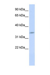 CDK5 antibody LS-C102826 Western blot of 721_B Cell lysate. Antibody concentration 1 ug/ml.