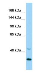 CDK5 antibody Western Blot of Rat Heart.