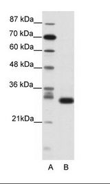 A: Marker, B: Jurkat Cell Lysate