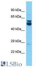 A1CF / ACF antibody Western Blot of Liver Tumor. Antibody dilution: 1 ug/ml.