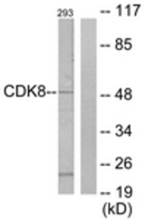 Western blot of extracts from 293 cells, using CDK8 Antibody. The lane on the right is treated with the synthesized peptide.