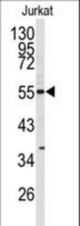 Western blot of CDK8 antibody in Jurkat cell line lysates (35 ug/lane). CDK8 (arrow) was detected using the purified antibody.